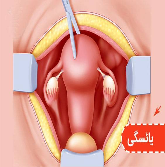 یائسگی زنان و بهترین داروهای افزایش میل جنسی